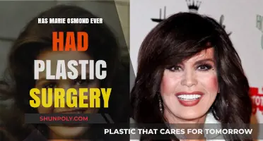 Marie Osmond's Transformation: Plastic Surgery Rumors and Reality Revealed