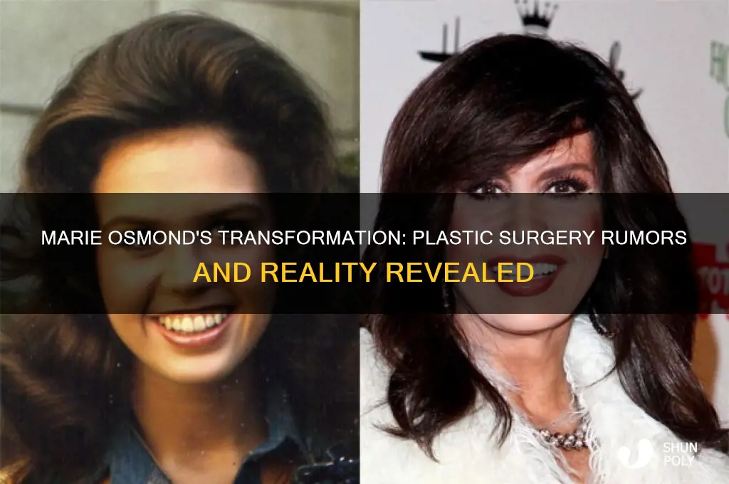has marie osmond ever had plastic surgery