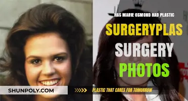Marie Osmond's Transformation: Plastic Surgery Speculations and Photos