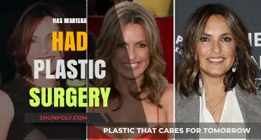 Mariska Hargitay's Transformation: Plastic Surgery Speculations and Truths