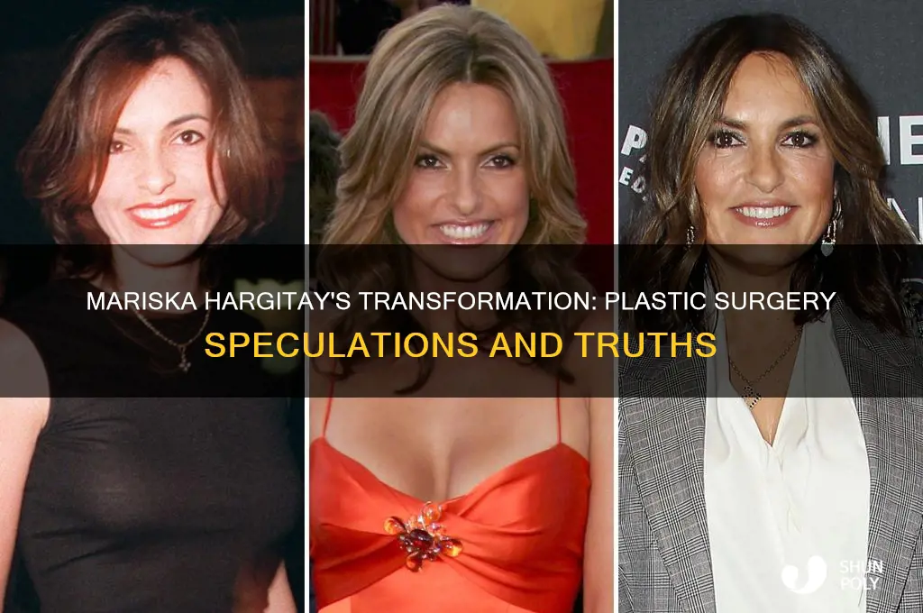 has mariska had plastic surgery