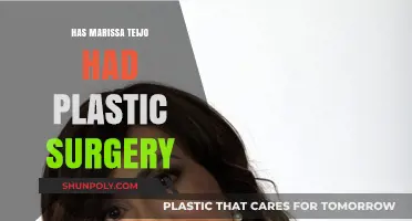 Marissa Teijo's Transformation: Plastic Surgery Rumors Explored