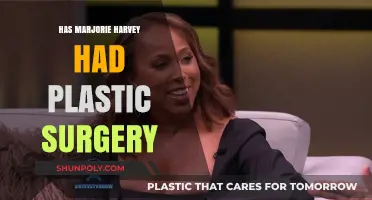 Marjorie Harvey's Transformation: Plastic Surgery Speculations and Truths Revealed