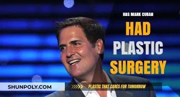 Mark Cuban's Transformation: Plastic Surgery Rumors Explored and Debunked
