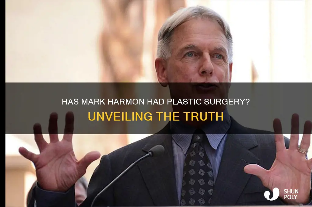 has mark harmon had plastic surgery