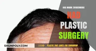 Has Mark Zuckerberg Had Plastic Surgery? Uncovering the Truth