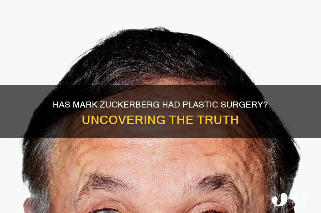 has mark zuckerberg had plastic surgery