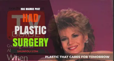 Markie Post Plastic Surgery: Fact-Checking the Rumors and Speculations