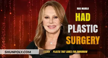 Has Marlo Had Plastic Surgery? Uncovering the Truth Behind Her Look