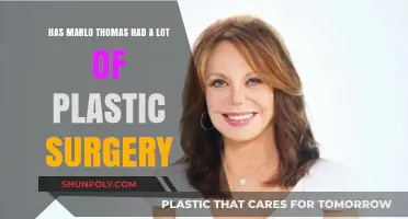 Marlo Thomas' Transformation: Plastic Surgery Speculations and Truths