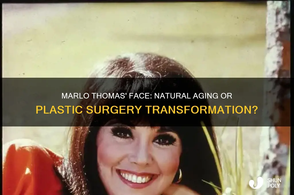 has marlo thomas had plastic surgery on her face