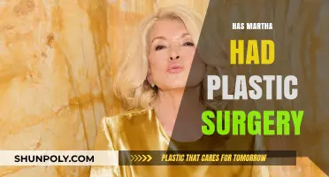 Martha's Transformation: Plastic Surgery Speculations and the Truth Revealed