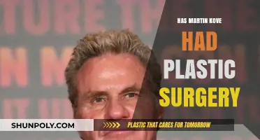 Martin Kove Plastic Surgery: Fact-Checking the Rumors and Speculations