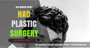 Martin Short's Youthful Look: Plastic Surgery Speculations Explored