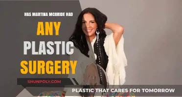Martina McBride's Transformation: Plastic Surgery Rumors Explored