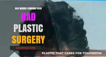 Has Marie Osmond Had Plastic Surgery? Unveiling the Truth