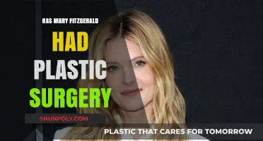 Mary Fitzgerald's Transformation: Plastic Surgery Speculations and Truths Revealed