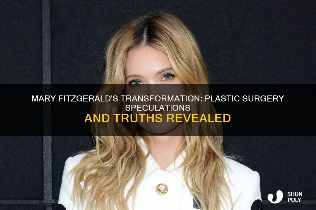 has mary fitzgerald had plastic surgery