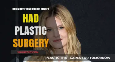 Mary Fitzgerald's Transformation: Plastic Surgery Rumors on Selling Sunset