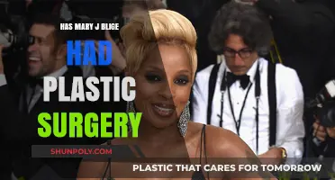 Mary J. Blige's Transformation: Plastic Surgery Speculations and Truths