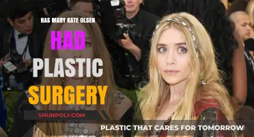 Mary-Kate Olsen's Transformation: Plastic Surgery Rumors Explored