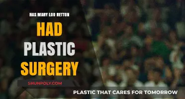 Mary Lou Retton Plastic Surgery: Fact-Checking the Rumors and Speculations