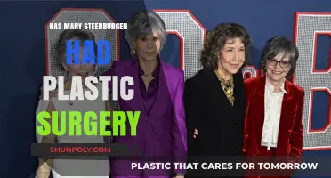 Mary Steenburgen's Ageless Beauty: Plastic Surgery Speculations Explored