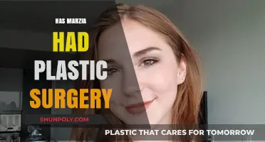 Has Marzia Had Plastic Surgery? Uncovering the Truth Behind the Rumors