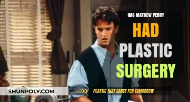 Mathew Perry's Transformation: Plastic Surgery Rumors Explored and Debunked