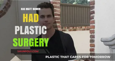 Matt Bomer Plastic Surgery: Fact-Checking the Transformation Rumors