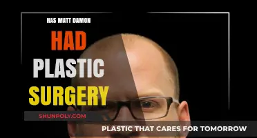 Matt Damon's Appearance: Plastic Surgery Speculations and the Truth