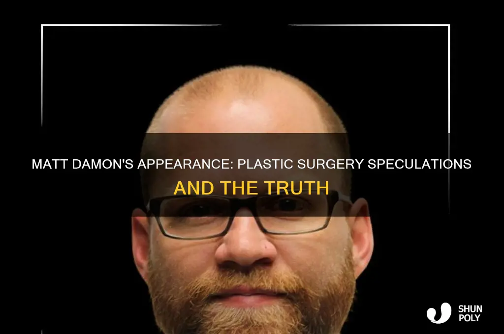 has matt damon had plastic surgery