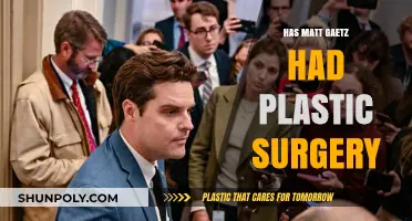 Matt Gaetz Plastic Surgery Speculations: Fact or Fiction?