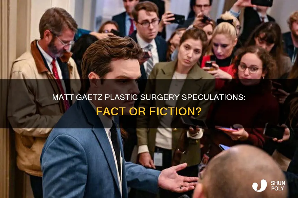 has matt gaetz had plastic surgery