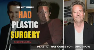 Matt LeBlanc's Changing Looks: Plastic Surgery Rumors Explored