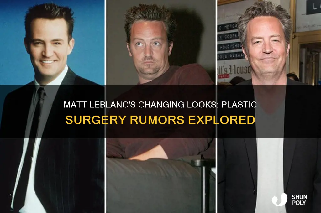 has matt leblanc had plastic surgery