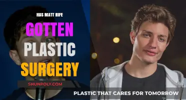 Matt Rife Plastic Surgery: Fact or Fiction? Unveiling the Truth