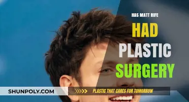 Matt Rife's Transformation: Plastic Surgery Rumors Explored and Debunked