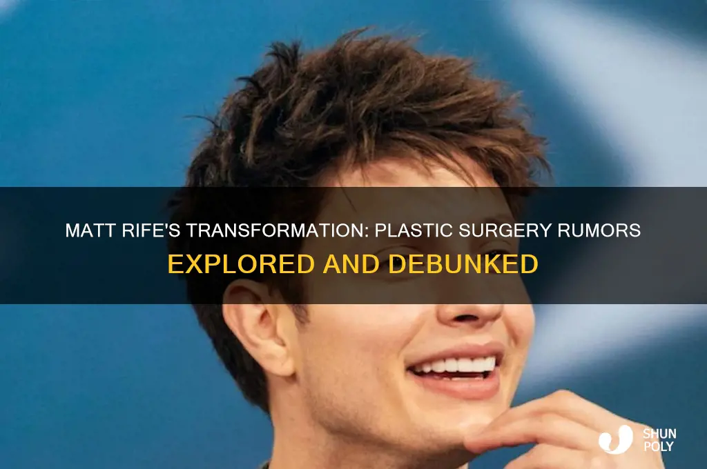 has matt rife had plastic surgery