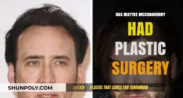 Matthew McConaughey's Transformation: Plastic Surgery Rumors Explored