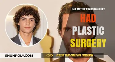 Matthew McConaughey's Transformation: Plastic Surgery Rumors Explored