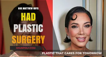 Has Matthew Rhys Had Plastic Surgery? Uncovering the Truth
