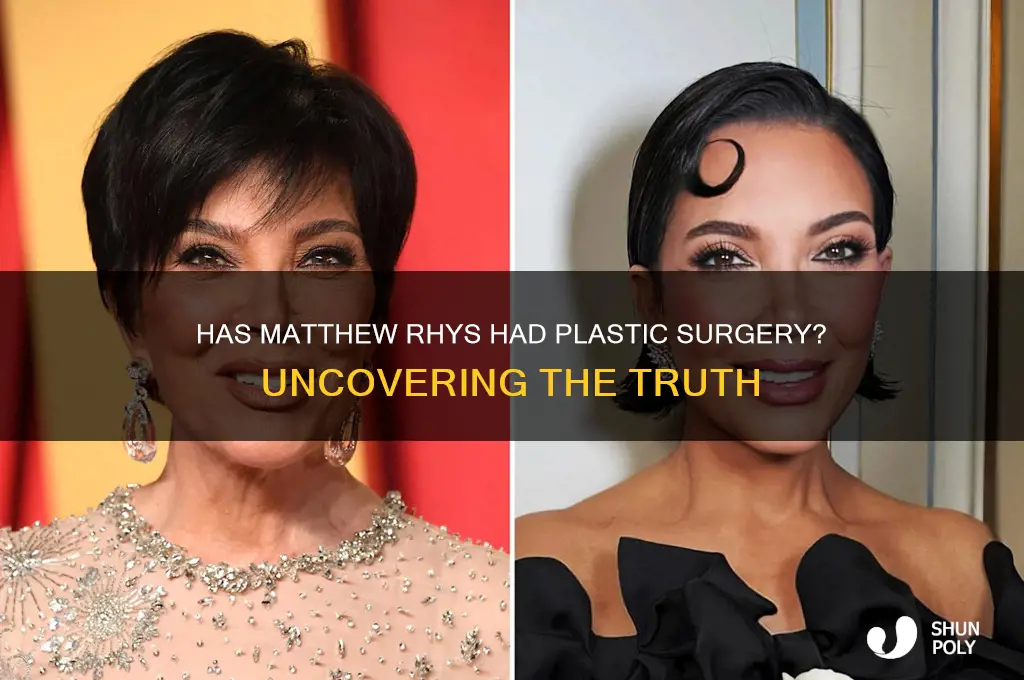 has matthew rhys had plastic surgery