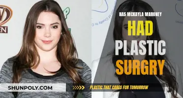 Did McKayla Maroney Have Plastic Surgery?