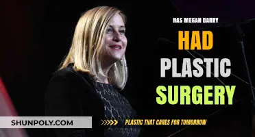 Megan Barry Plastic Surgery: Fact-Checking Rumors and Speculations