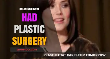 Megan Boone Plastic Surgery: Fact-Checking Rumors and Speculations
