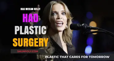 Megan Kelly's Transformation: Plastic Surgery Rumors Explored and Analyzed