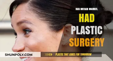 Megan Markle's Transformation: Plastic Surgery Speculations and Facts Revealed