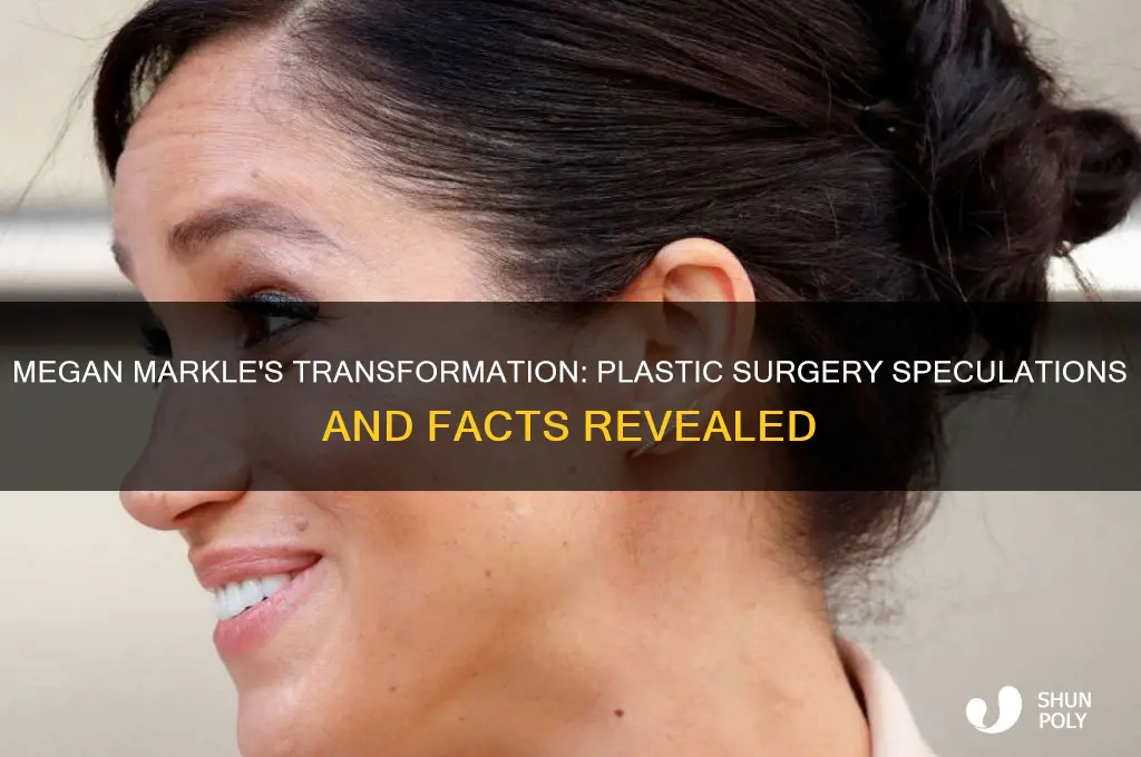 has megan markel had plastic surgery