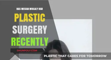 Megan Mulally's Recent Appearance: Plastic Surgery Speculations Explored